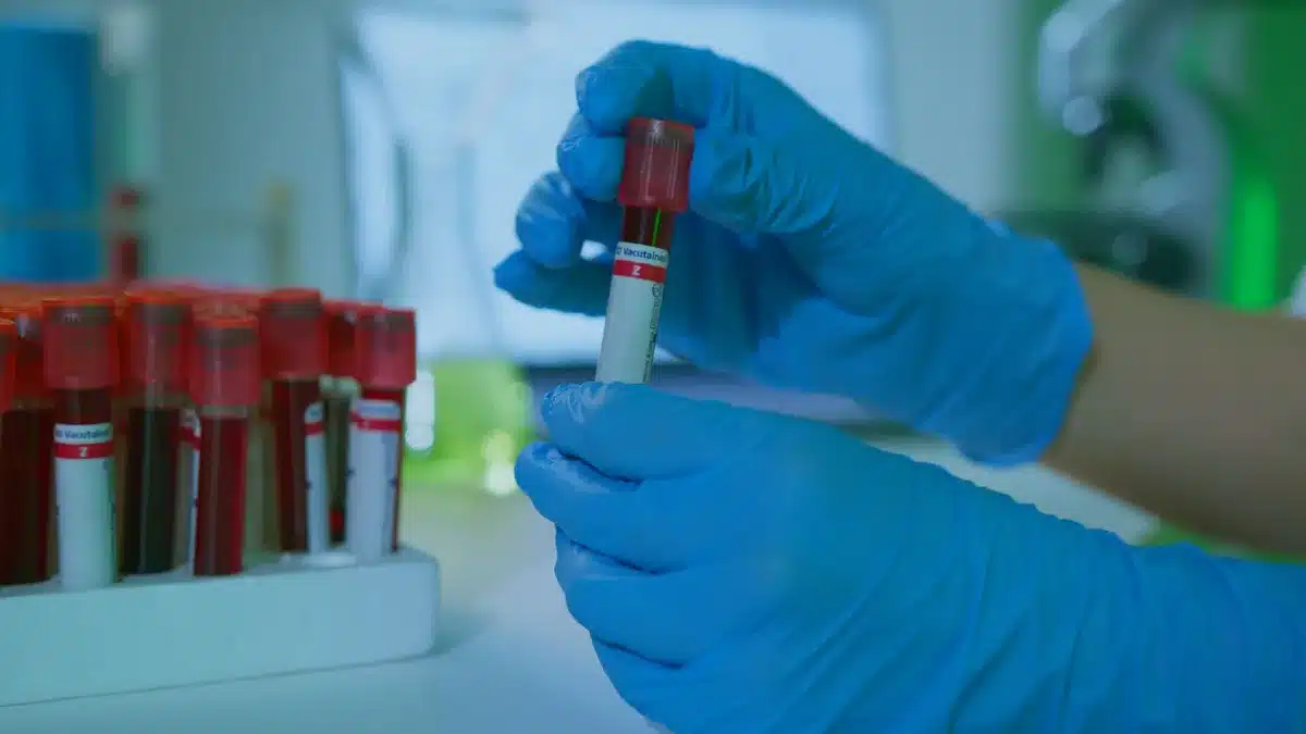 Tubes d'analyses sanguines traités dans un laboratoire médical pour obtenir les résultats.